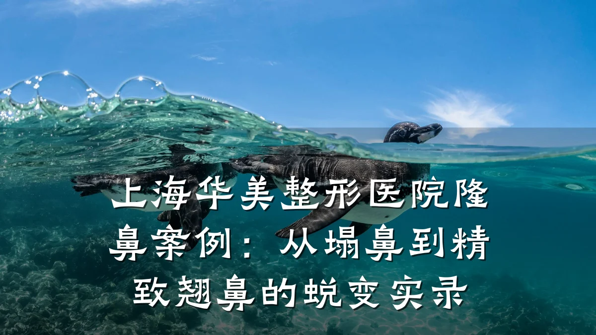 上海华美整形医院隆鼻案例:从塌鼻到精致翘鼻的蜕变实录